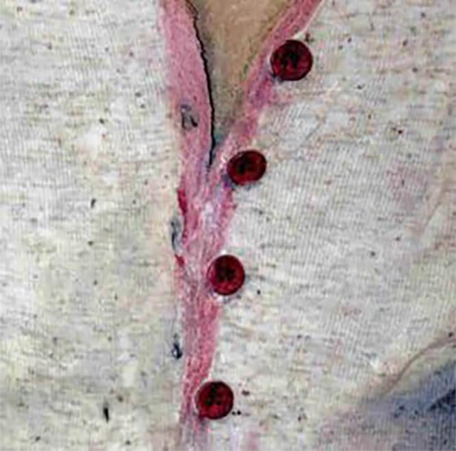 Το βάθος της επιφάνειας